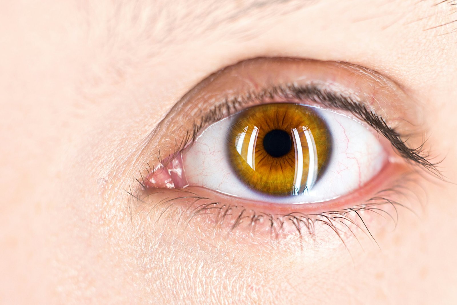 swollen eyelid